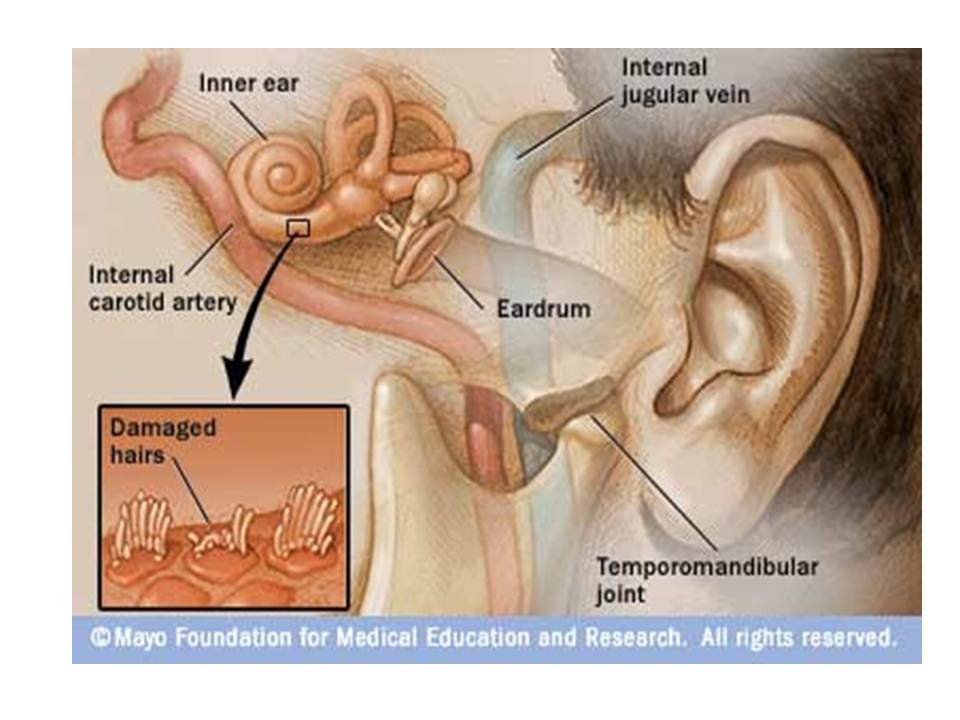 Ringing in the ears and diminished hearing associated with aging